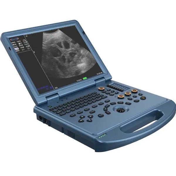 ECO-17Vet High end Equine Ultrasound with Rectal Probe 4-12 MHz Color Doppler DIAGNOSTIC ULTRASOUND MACHINES FOR SALE