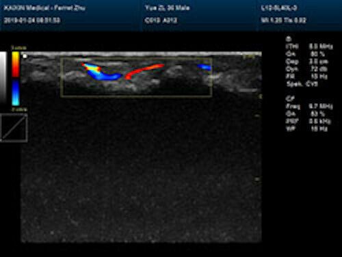 Newest- Farbe Tragbar Ultraschall & Ein Sonde, Dicom , LED Display DIAGNOSTIC ULTRASOUND MACHINES FOR SALE