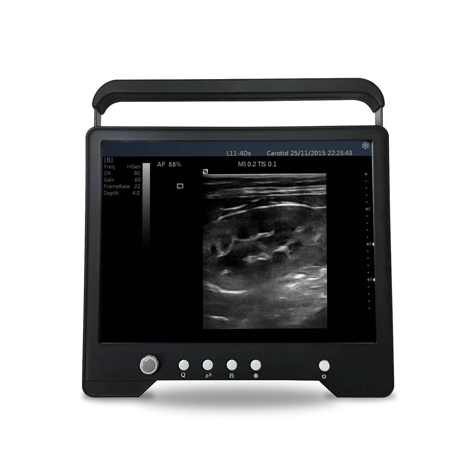 Tierärztlich Touchscreen Ultrasoundµ-convex Sonde für Klein Tiere, Keebomed DIAGNOSTIC ULTRASOUND MACHINES FOR SALE