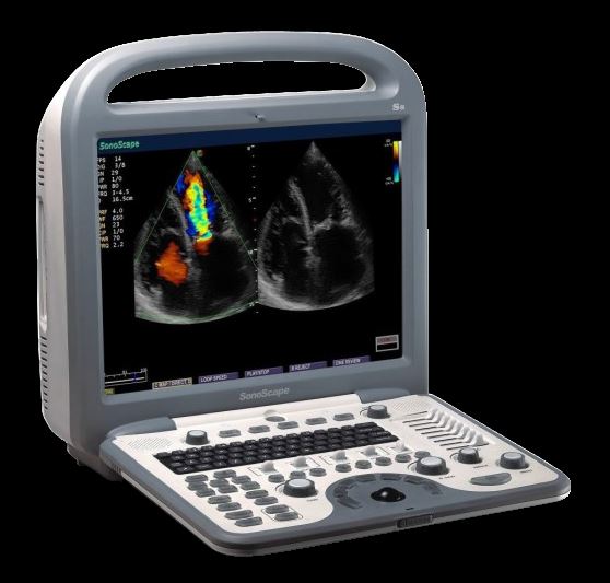 SonoScape S8 with L743 Linear array Probe Included - new DIAGNOSTIC ULTRASOUND MACHINES FOR SALE