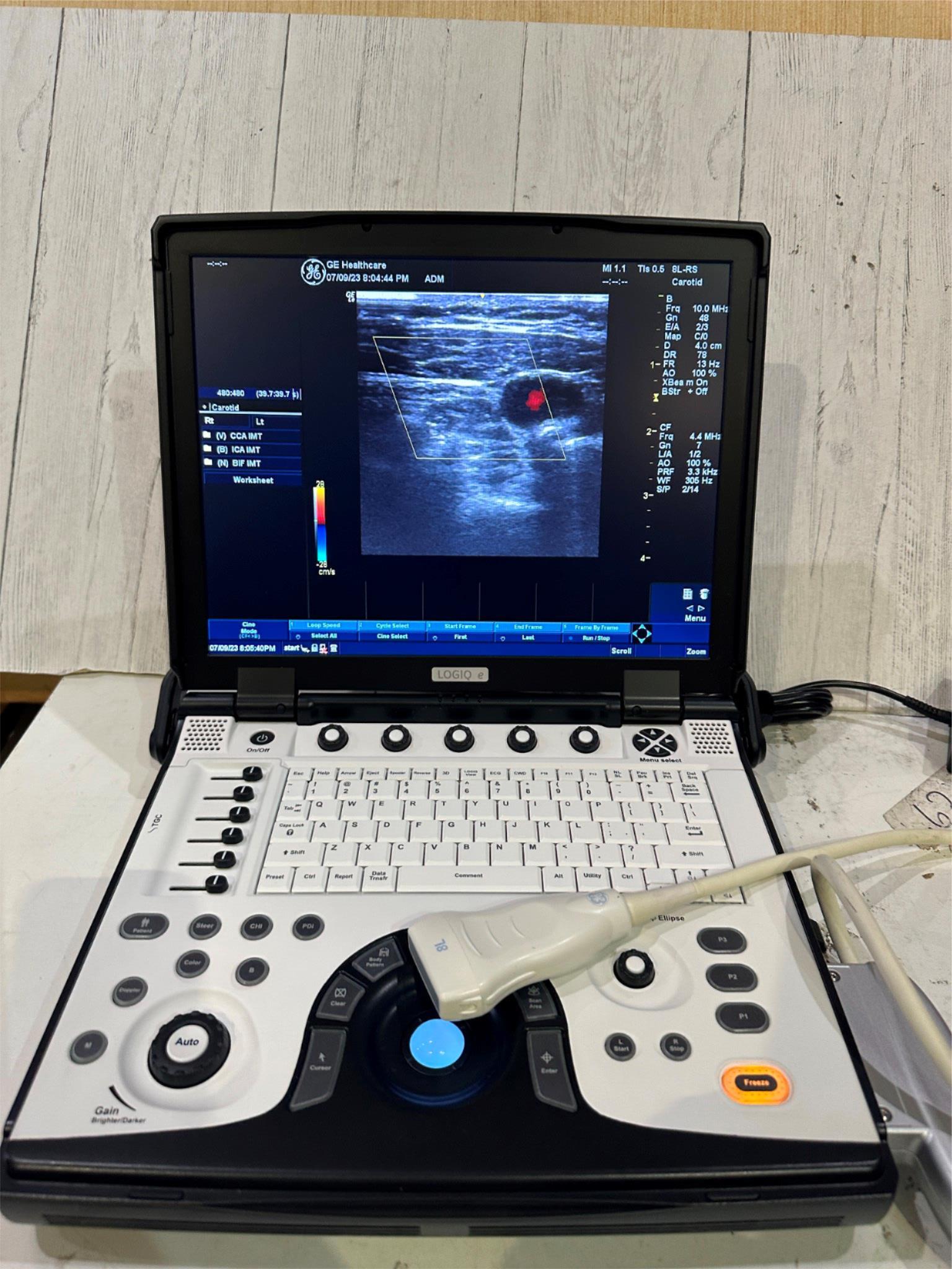BT12 GE LOGIQ E Next Ge Ultrasound DOM 2016 DIAGNOSTIC ULTRASOUND MACHINES FOR SALE