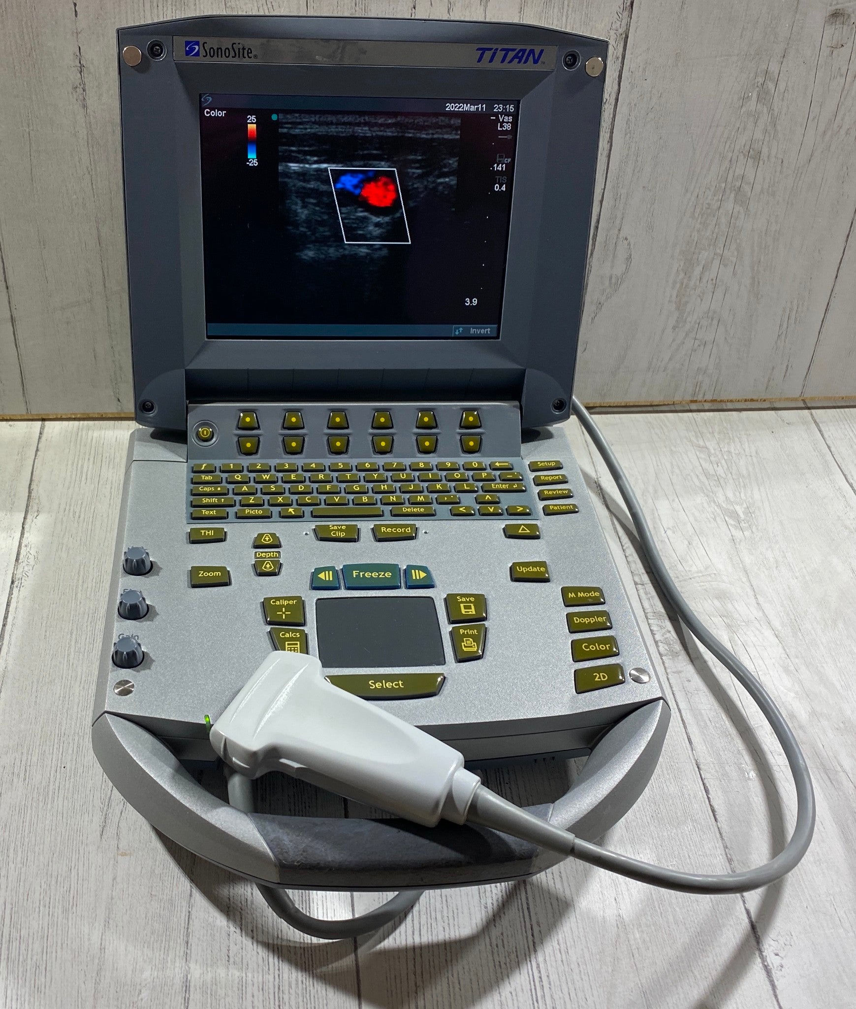 Sonosite Titan Portable Ultrasound 2005 - With Linear Array probe L25 Probe DIAGNOSTIC ULTRASOUND MACHINES FOR SALE