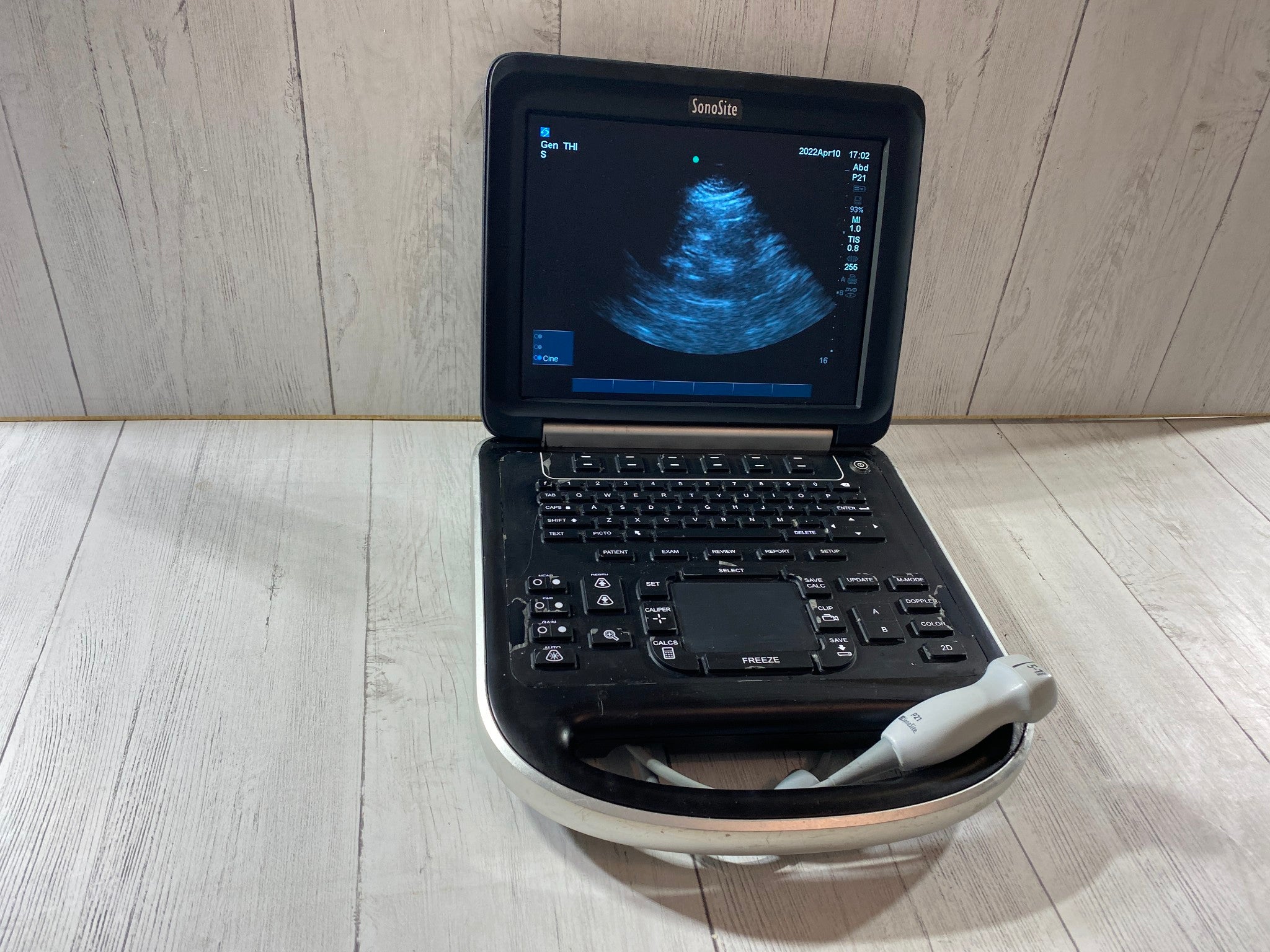 Sonosite Edge Portable ultrasound Manufactured 2013 with P21 Cardiac probe DIAGNOSTIC ULTRASOUND MACHINES FOR SALE