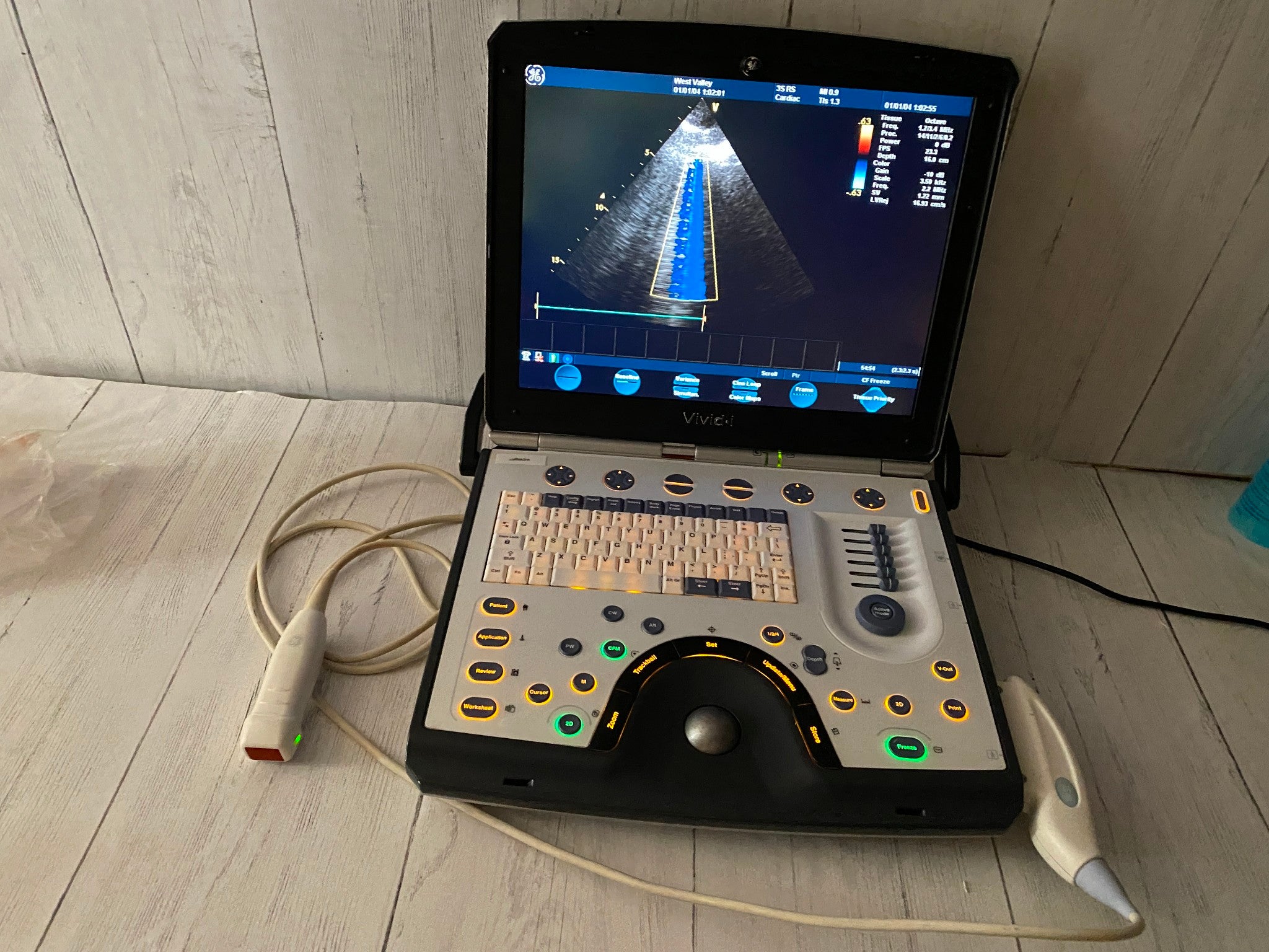GE Vivid I Color Doppler Ultrasound Scanner, CW BT10 with 3s-RS cardiac probe DIAGNOSTIC ULTRASOUND MACHINES FOR SALE