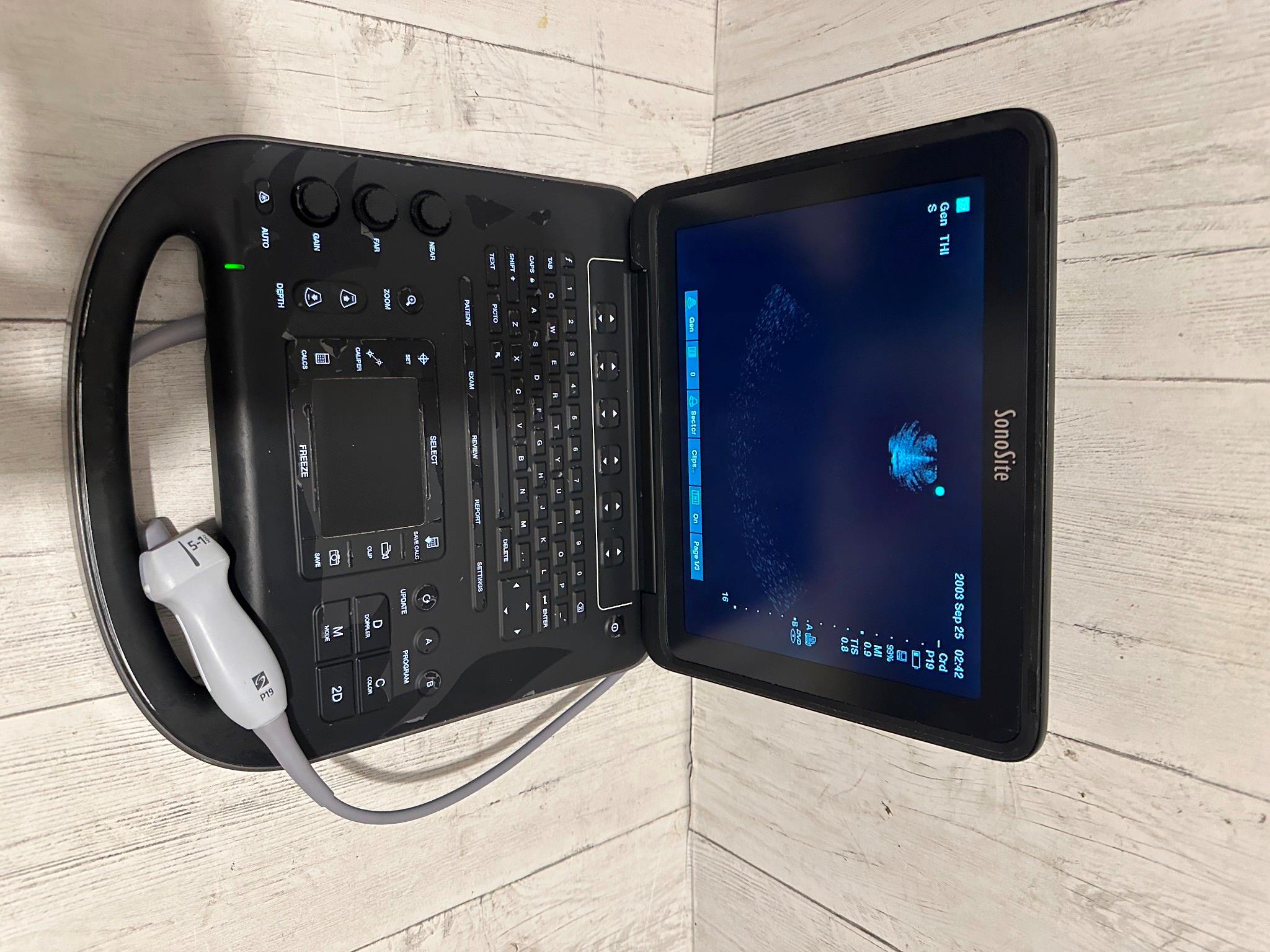 Sonosite Edge II Ultrasound 2016, DICOM with Phased Array probe rP19x DIAGNOSTIC ULTRASOUND MACHINES FOR SALE