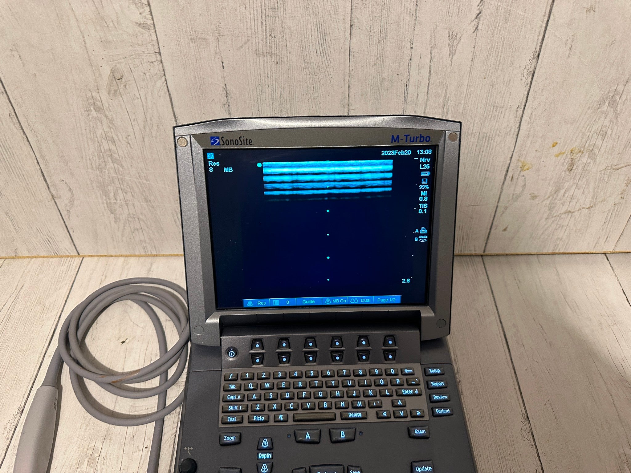 SonoSite M-Turbo Portable Ultrasound 2010 with Mini Dock Station DIAGNOSTIC ULTRASOUND MACHINES FOR SALE