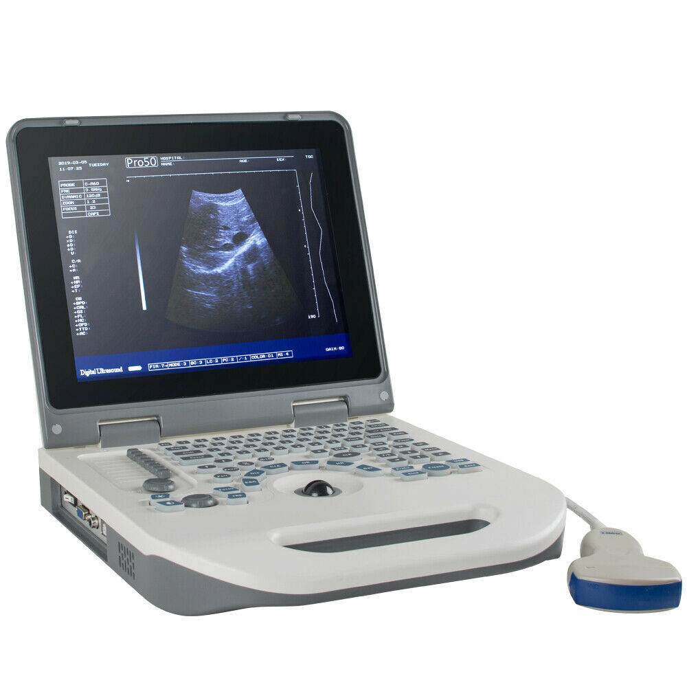 Portable Laptop Machine Digital Ultrasound scanner 3.5MHz Convex probe 3D Staion DIAGNOSTIC ULTRASOUND MACHINES FOR SALE