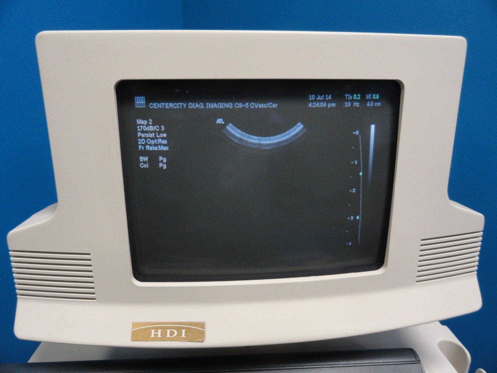 ATL C8-5 14R Micro-Convex Pediatric Small Parts Vascular MSK OB Probe (6865) DIAGNOSTIC ULTRASOUND MACHINES FOR SALE