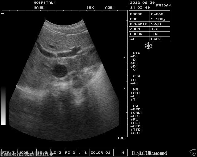 Veterinary B-Ultrasound Scanner/Machine Micro-convex Array Probe VET/Animals 3D 190891949295 DIAGNOSTIC ULTRASOUND MACHINES FOR SALE