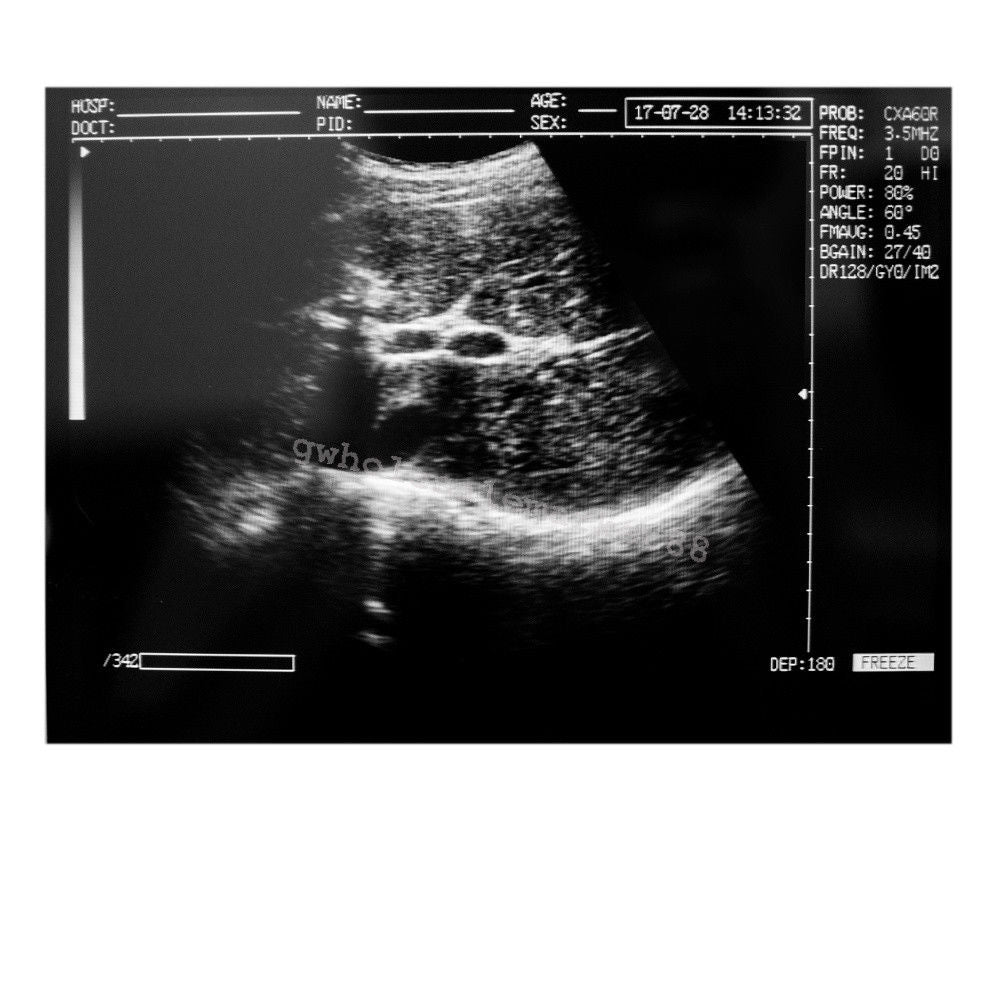 Portable Ultrasound Machine Scanner System Convex probe 3D Software Image Photo 190891045898 DIAGNOSTIC ULTRASOUND MACHINES FOR SALE