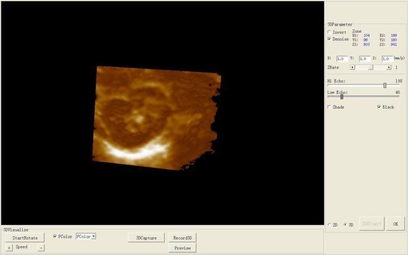 Digital Ultrasound Scanner B ultrasonic Machine Convex Micro-Convex 2 probe 3D 190891391452 DIAGNOSTIC ULTRASOUND MACHINES FOR SALE