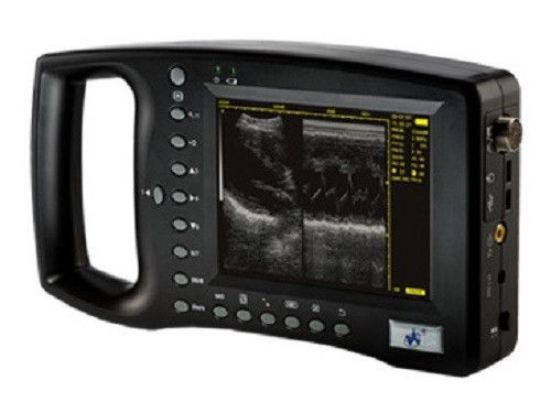 Handheld Palm Ultrasound Scanner WED-3100 With Linear Array Probe 6.5/.5/8.5MHz DIAGNOSTIC ULTRASOUND MACHINES FOR SALE