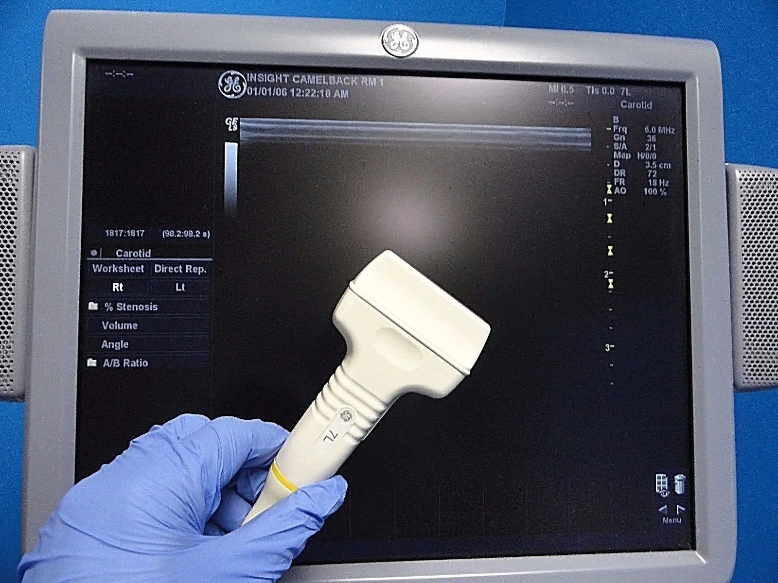 GE 7L / 2302648 Linear Array Ultrasound Probe for Logiq & Vivid Series~13787 DIAGNOSTIC ULTRASOUND MACHINES FOR SALE