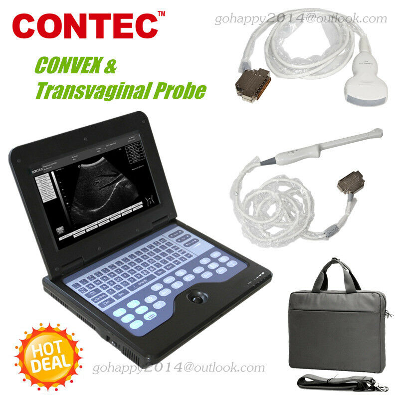 3.5Mhz CONVEX & transvaginal probe Portable Notebook Laptop Ultrasound Scanner 790996133775 DIAGNOSTIC ULTRASOUND MACHINES FOR SALE