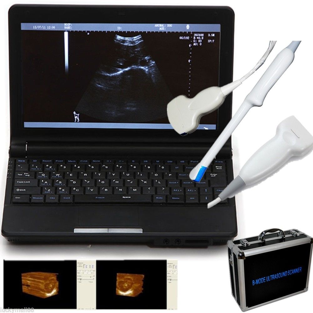 Portable ultrasound scanner laptop machine 3 Probe Convex/Linear/Transvaginal Sy DIAGNOSTIC ULTRASOUND MACHINES FOR SALE