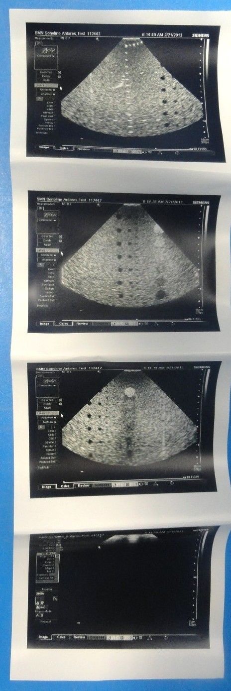 2008 Siemens Acuson Antares PH4-1 Frequency 4–1 MHz Ultrasound Probe (6831) DIAGNOSTIC ULTRASOUND MACHINES FOR SALE