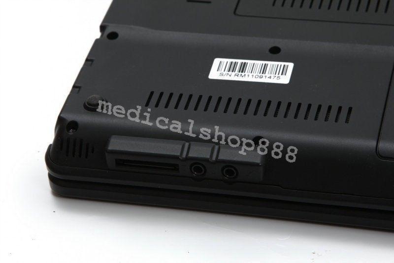 Sale! 10Inch Laptop Ultrasound Scanner with linear probe 3D Ultrasound Device 190891478627 DIAGNOSTIC ULTRASOUND MACHINES FOR SALE