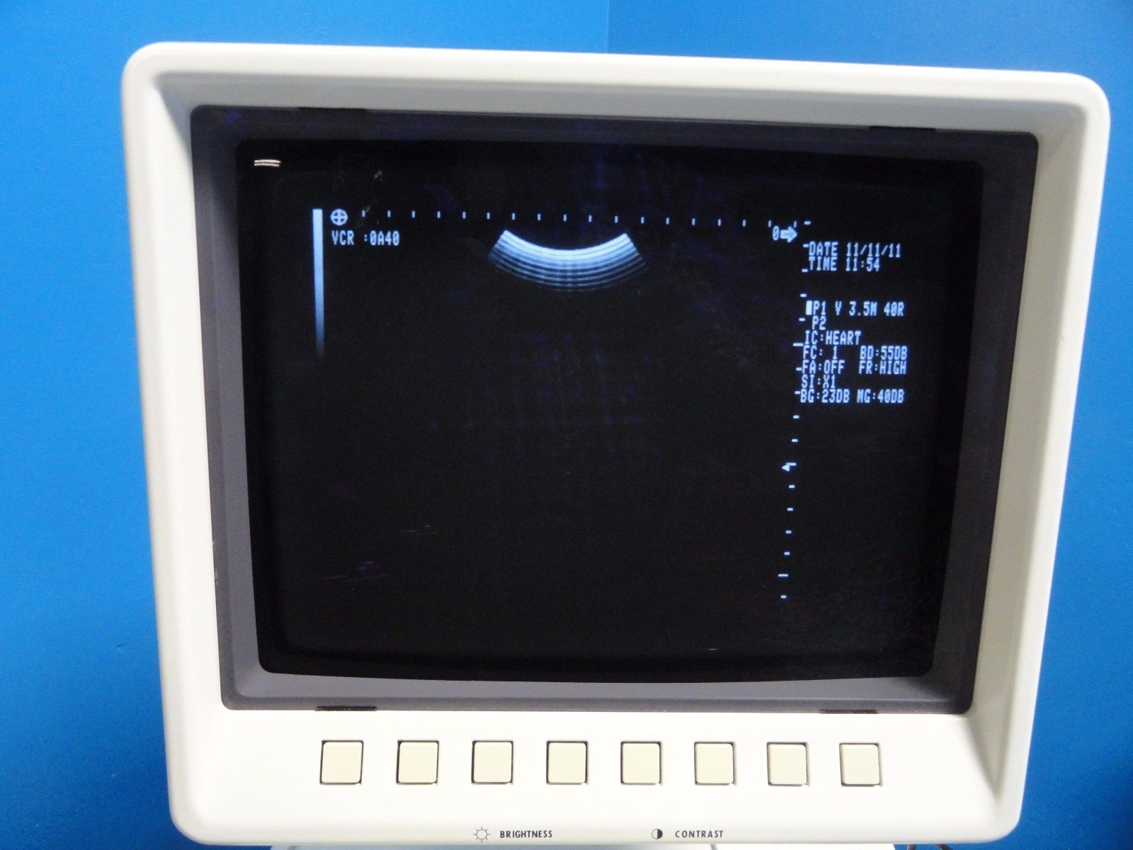 Shimadzu VA40R-035U 3.5 MHz 40mm Convex Probe for SDU-1100 SDU-400 SDU-450~13538 DIAGNOSTIC ULTRASOUND MACHINES FOR SALE