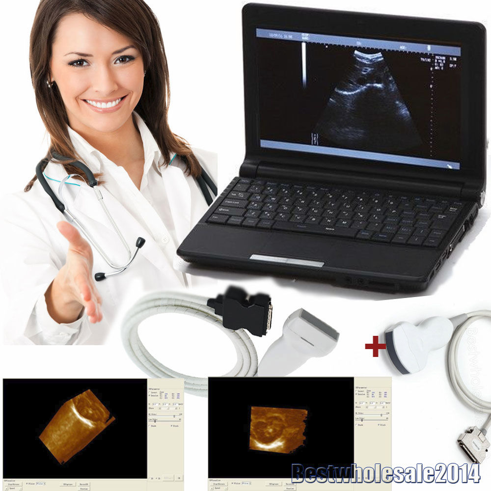 Laptop Ultrasound Scanner Convex & Linear + 3D 2 Probes USB Port Free 3D DIAGNOSTIC ULTRASOUND MACHINES FOR SALE