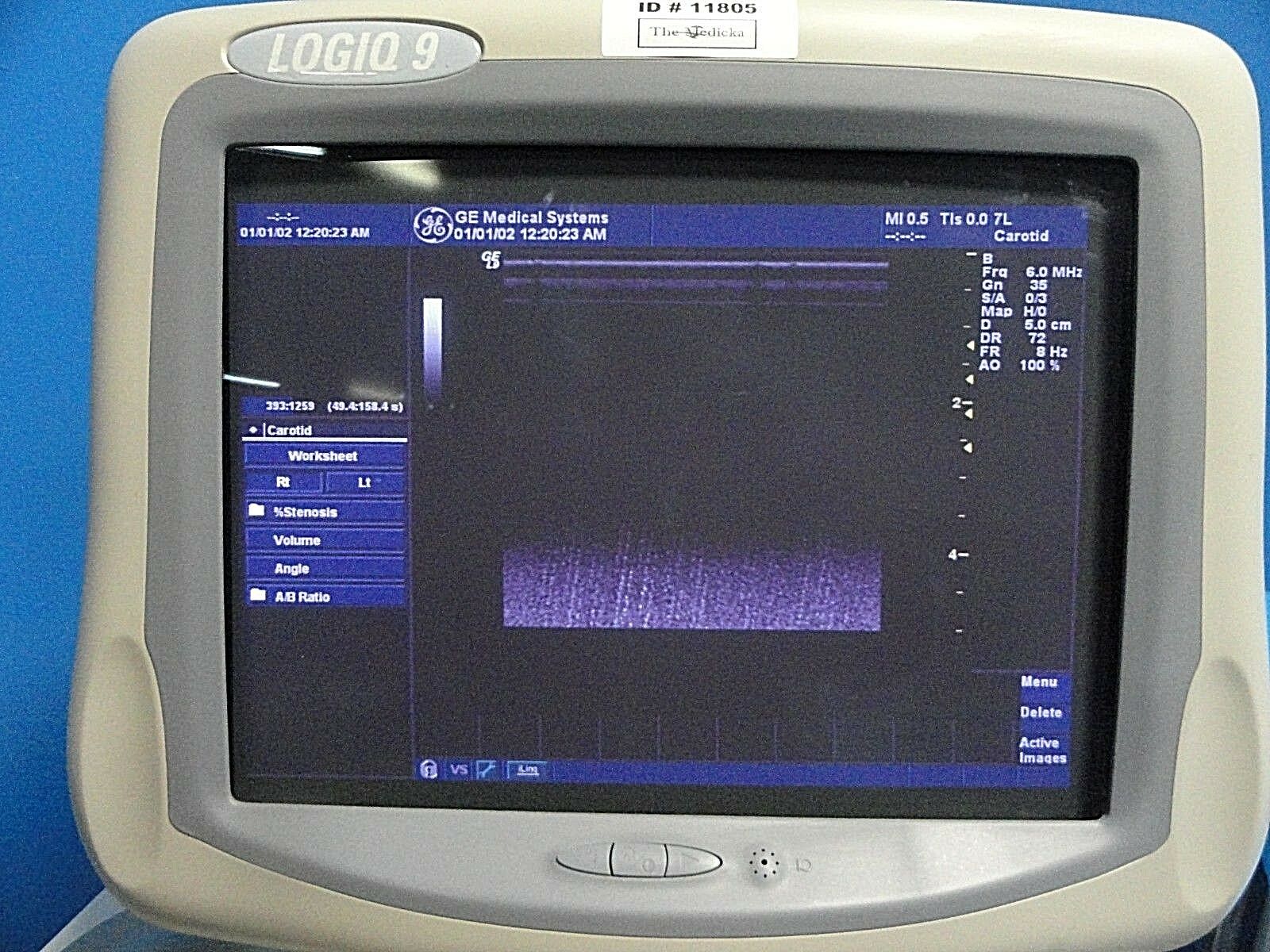 2011 GE 7L P/N 2302648 Linear Ultrasound Probe For Logiq & Vivid Series~16678 DIAGNOSTIC ULTRASOUND MACHINES FOR SALE