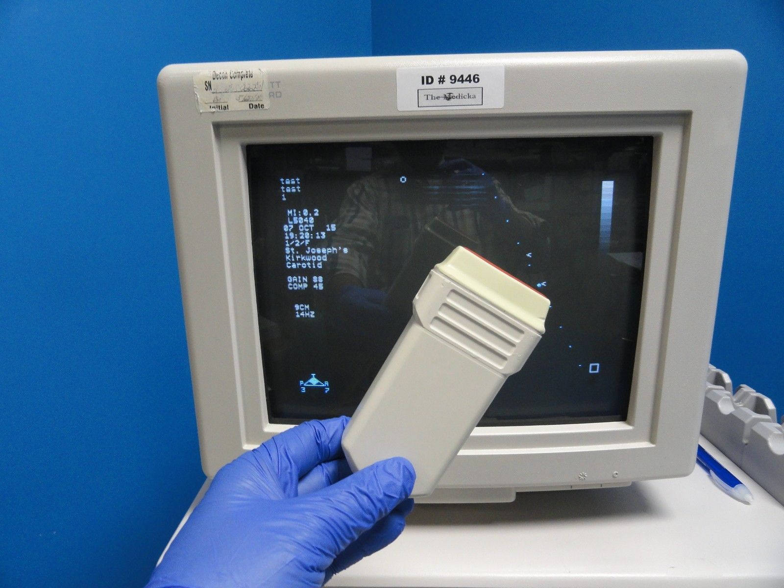 a hand in a blue glove is touching probe with a monitor behind