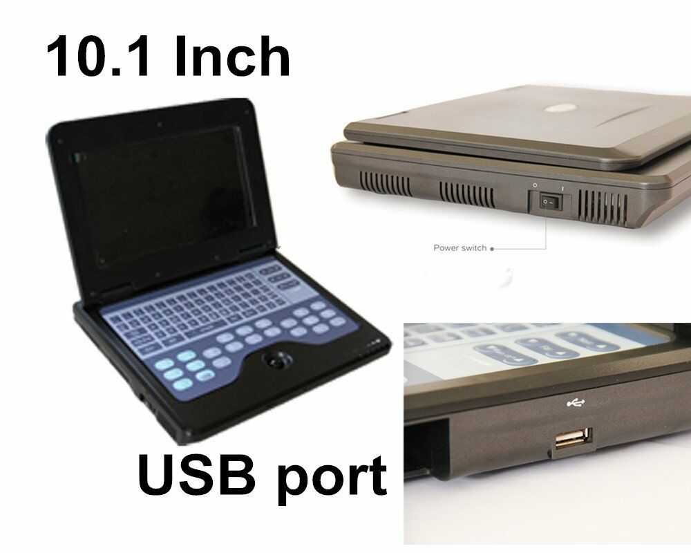 Newest Digital Portable Laptop Ultrasound Scanner Machine,7.5MHz Linear probe US 658126883672 DIAGNOSTIC ULTRASOUND MACHINES FOR SALE