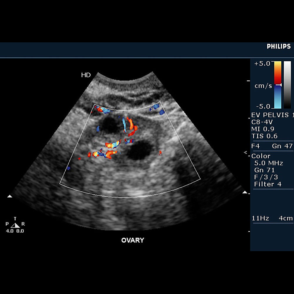 an ultrasound image of a body part