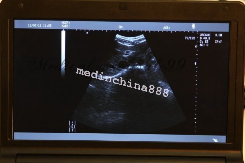 10.1'' Ultrasound Scanner With Convex+Linear+Transvaginal+Micro-Convex Probe Bid DIAGNOSTIC ULTRASOUND MACHINES FOR SALE