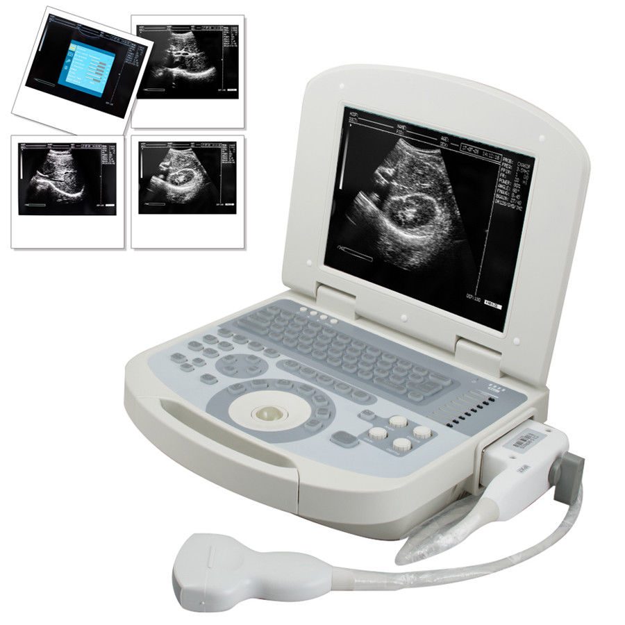 Portable Full Digital Laptop 10.4" Medical Ultrasound Scanner 3.5 Convex probe DIAGNOSTIC ULTRASOUND MACHINES FOR SALE