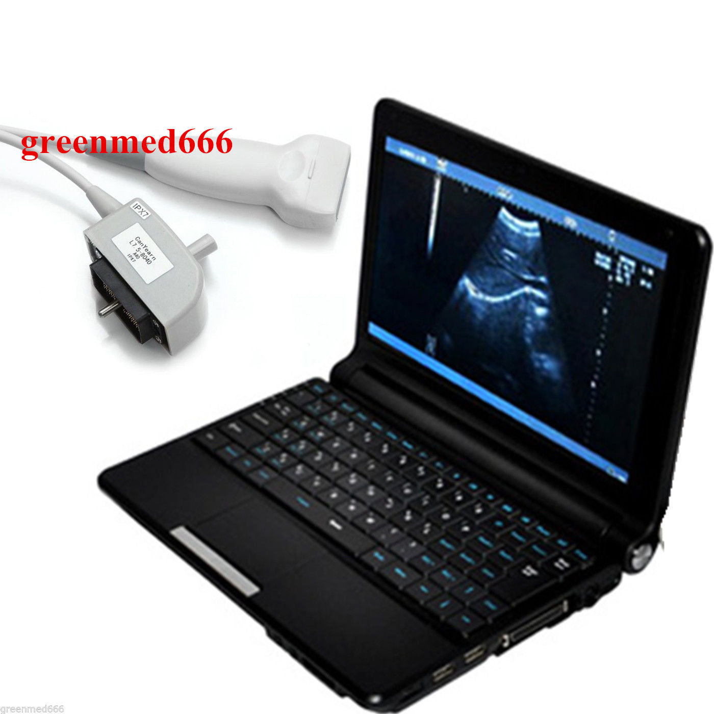 7.5M Linear Probe Full Digital Diagnostic System Ultrasound Scanner Machine New 190891735249 DIAGNOSTIC ULTRASOUND MACHINES FOR SALE