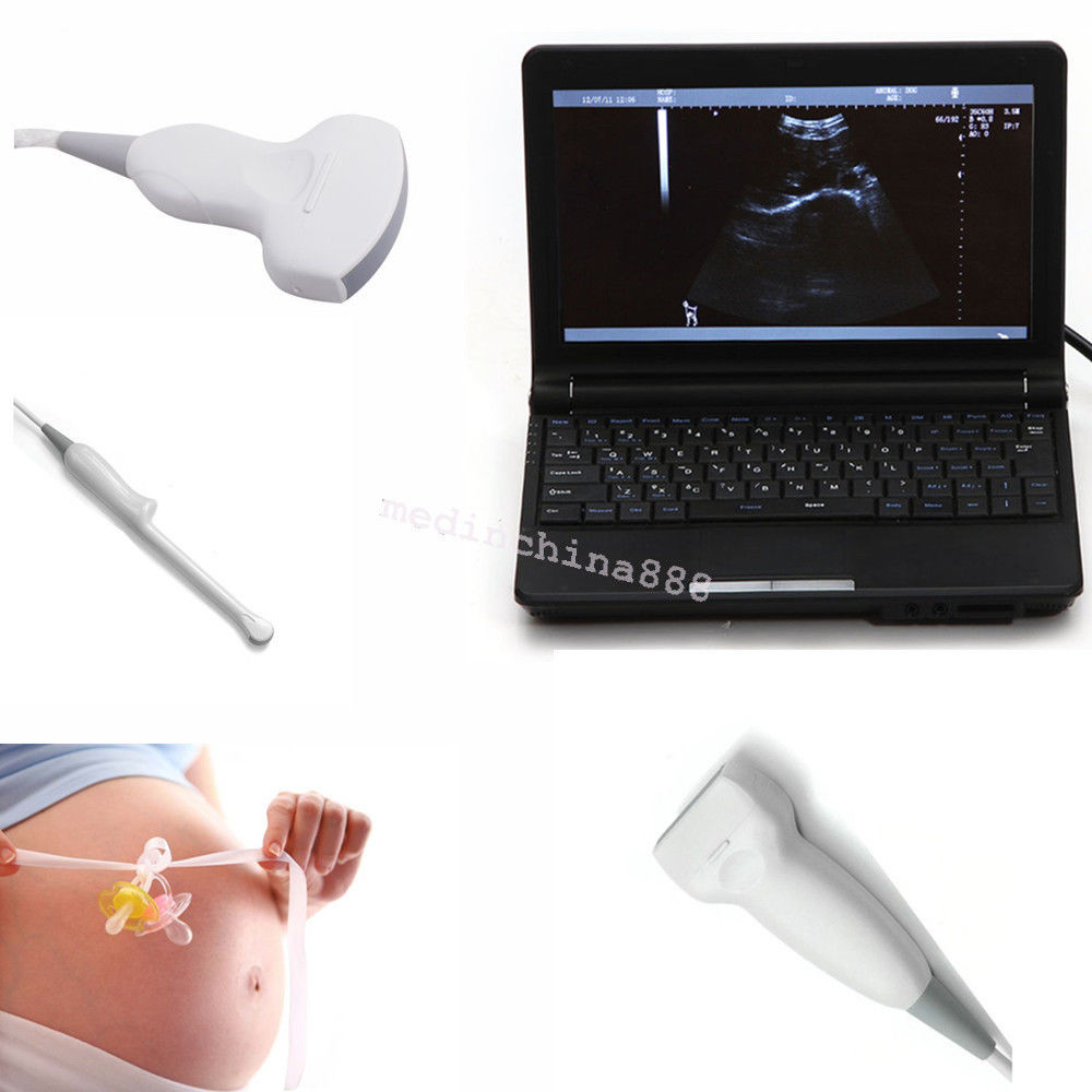 Laptop Ultrasound Scanner +Convex+Linear+Transvaginal 3 Probes Monitor Machine 190891247346 DIAGNOSTIC ULTRASOUND MACHINES FOR SALE