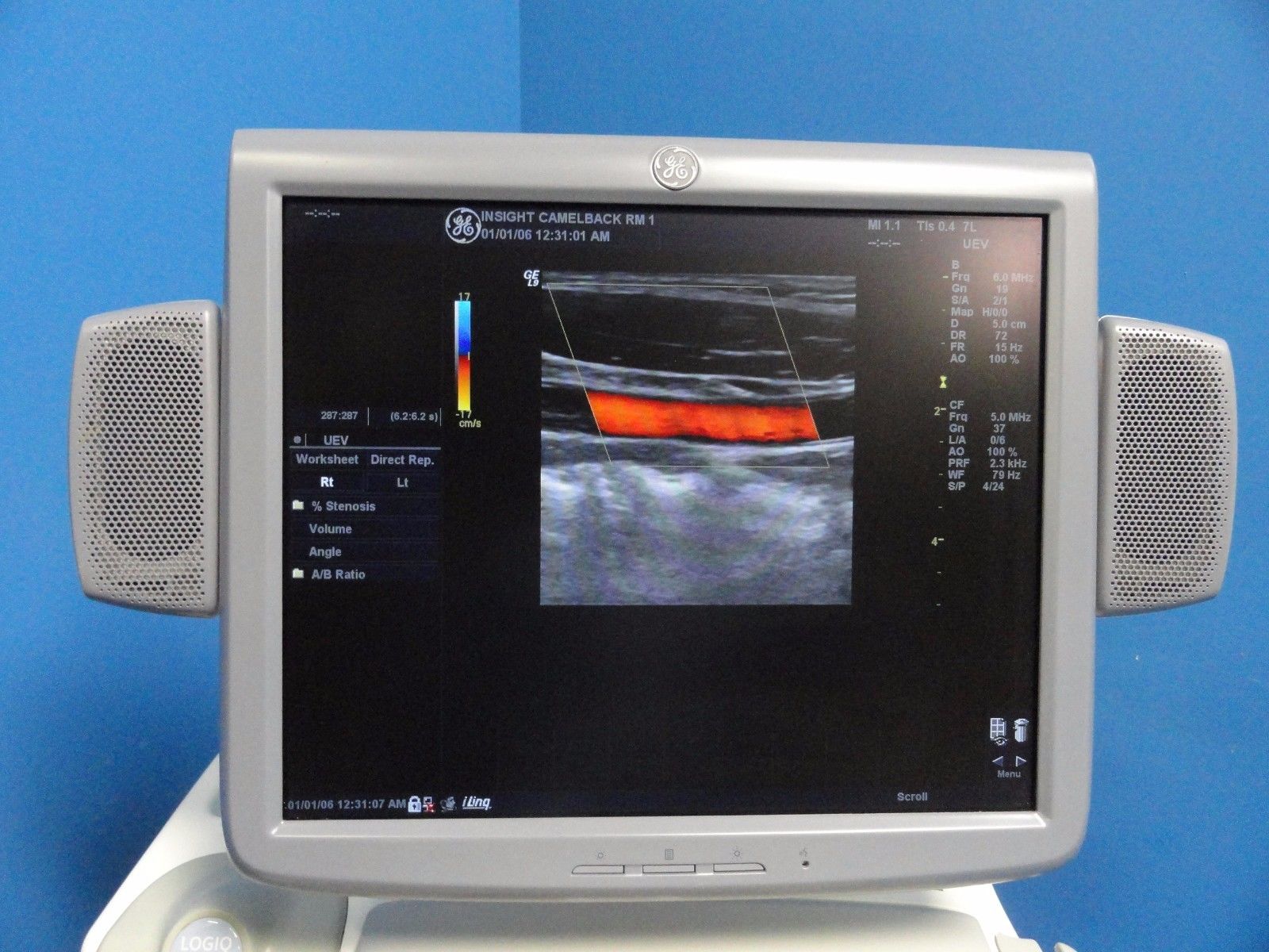 GE Logiq 9 LCD Ultrasound System W/ M12L, 7L, 4C, 4D3C-L Probes & Printer 10369 DIAGNOSTIC ULTRASOUND MACHINES FOR SALE