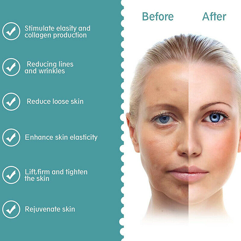 Mini Hifu Ultrasound Machine Face Lifting Skin Tighten Wrinkle Reduction Facial DIAGNOSTIC ULTRASOUND MACHINES FOR SALE