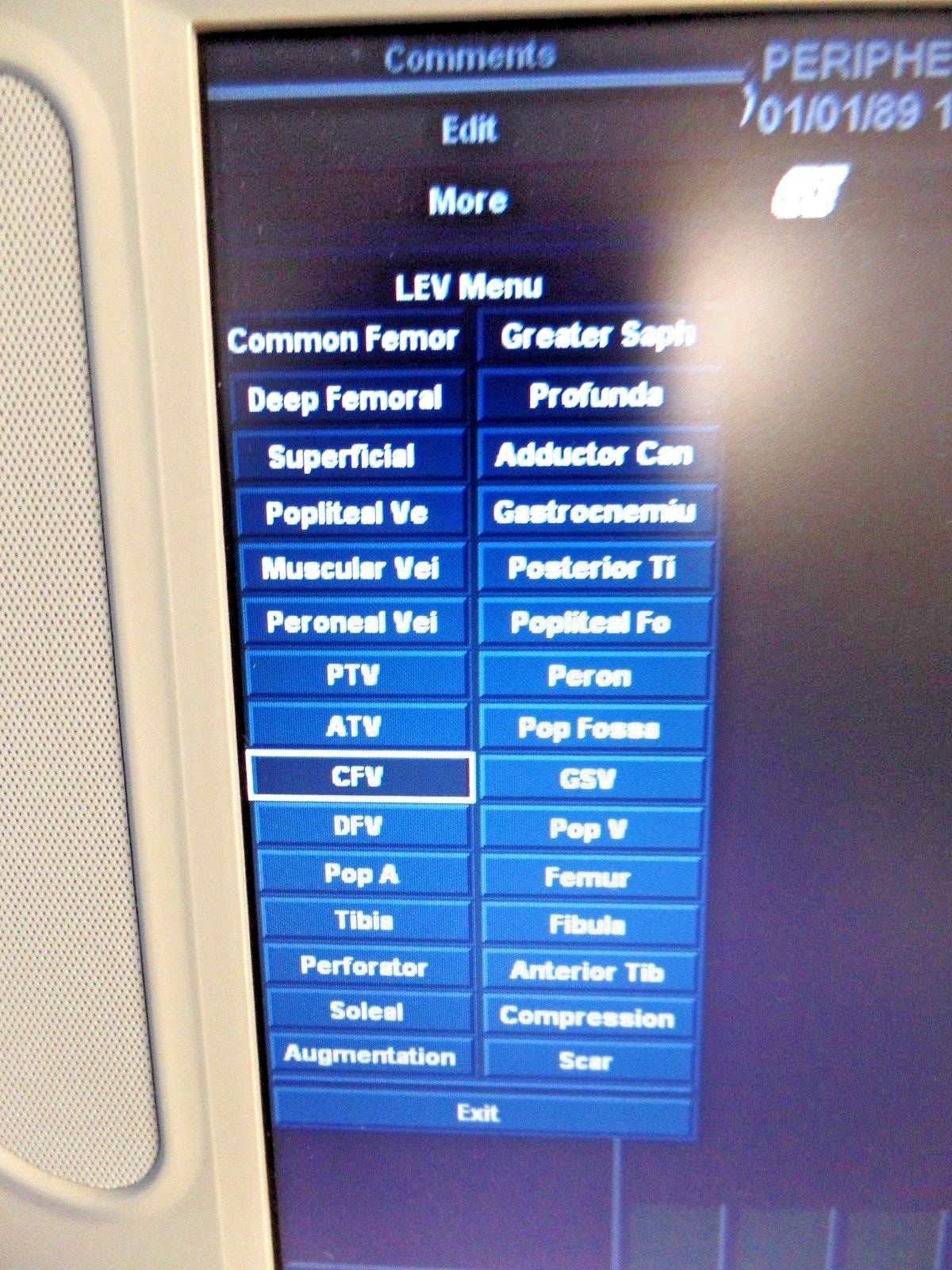 GE Logiq Book XP Ultrasound SV 2.0 with 8L-RS Probe DOM 2005 DIAGNOSTIC ULTRASOUND MACHINES FOR SALE