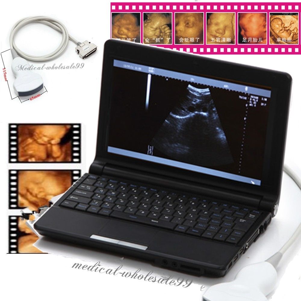 Portable Laptop Digital Ultrasound Scanner Conve/Vignal /Linear 3 Probe 3D Scan DIAGNOSTIC ULTRASOUND MACHINES FOR SALE