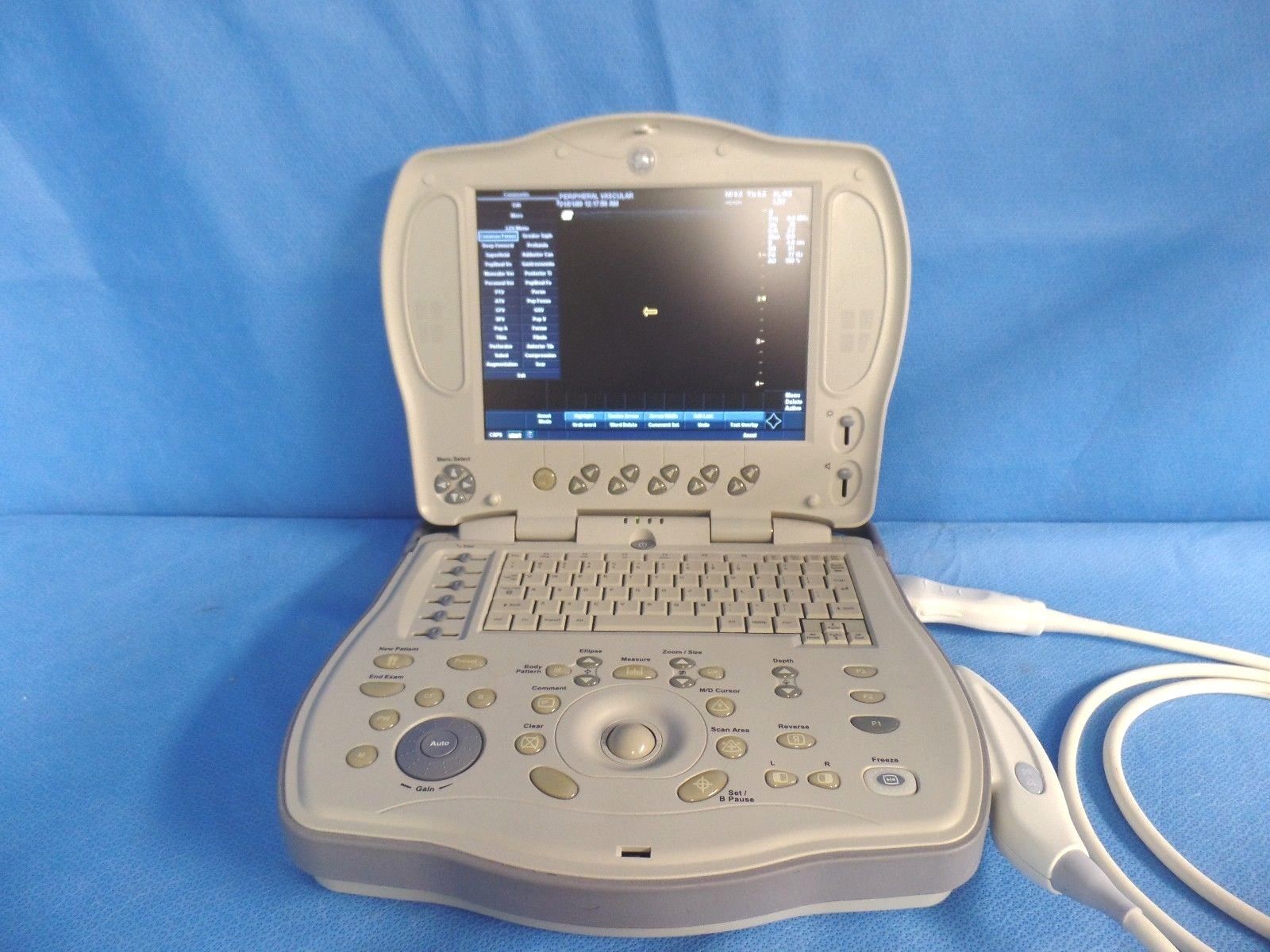 GE Logiq Book XP Ultrasound SV 2.0 with 8L-RS Probe DOM 2005 DIAGNOSTIC ULTRASOUND MACHINES FOR SALE