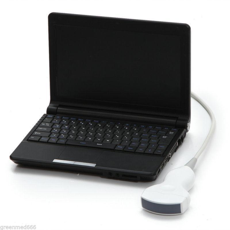 Color Full Digital Laptop 3D Ultrasound Scanner+Convex/Abdominal+Linear Probe CE DIAGNOSTIC ULTRASOUND MACHINES FOR SALE