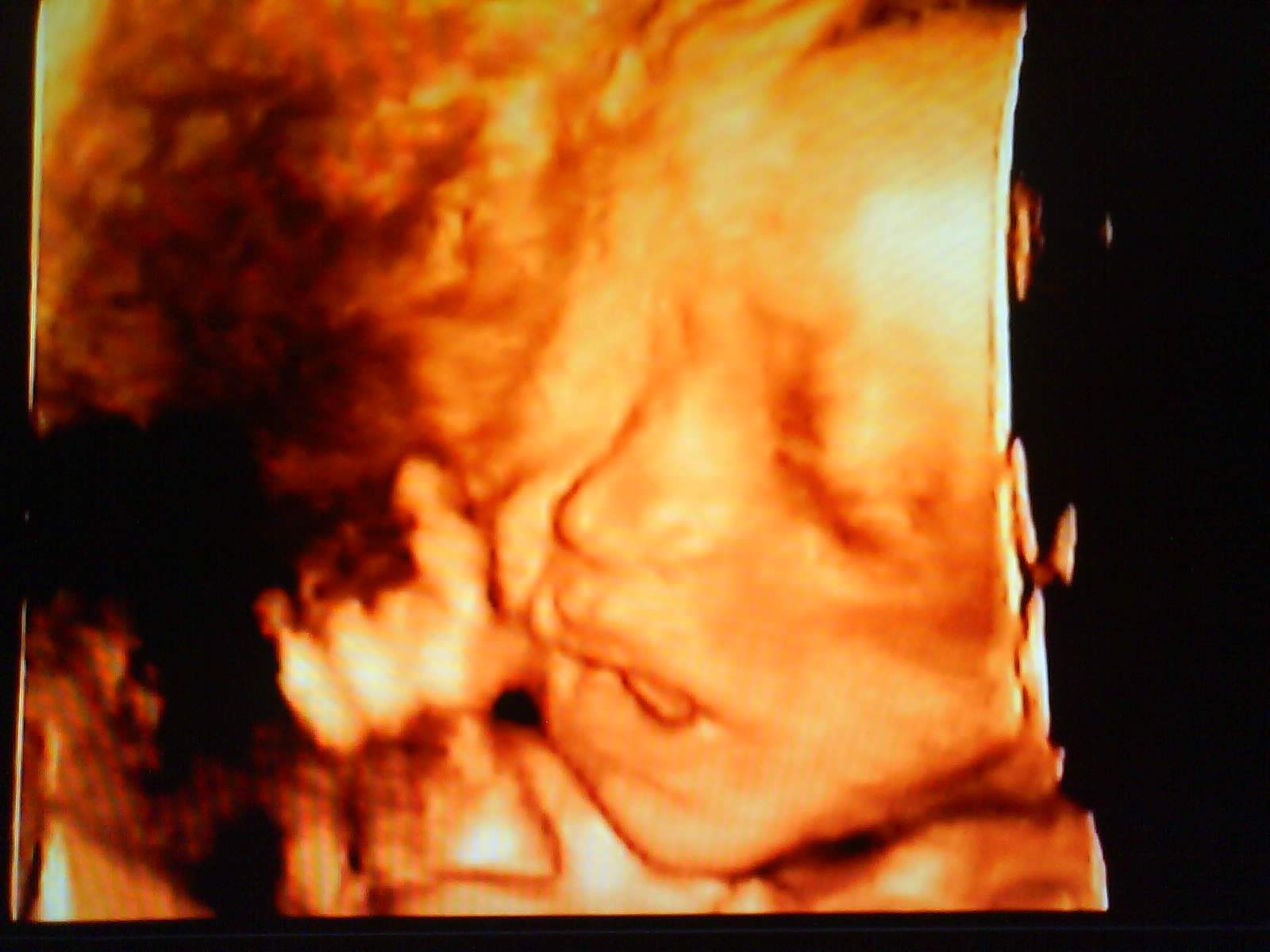 15" Doppler Ultrasound Diagnostic System Scanner Convex Transvaginal 2 Probe A+ 190891646774 DIAGNOSTIC ULTRASOUND MACHINES FOR SALE