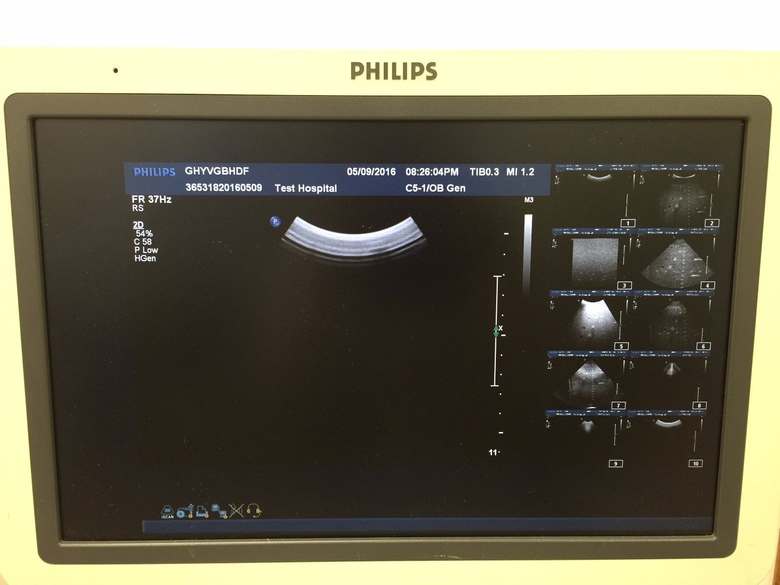 monitor of ultrasound