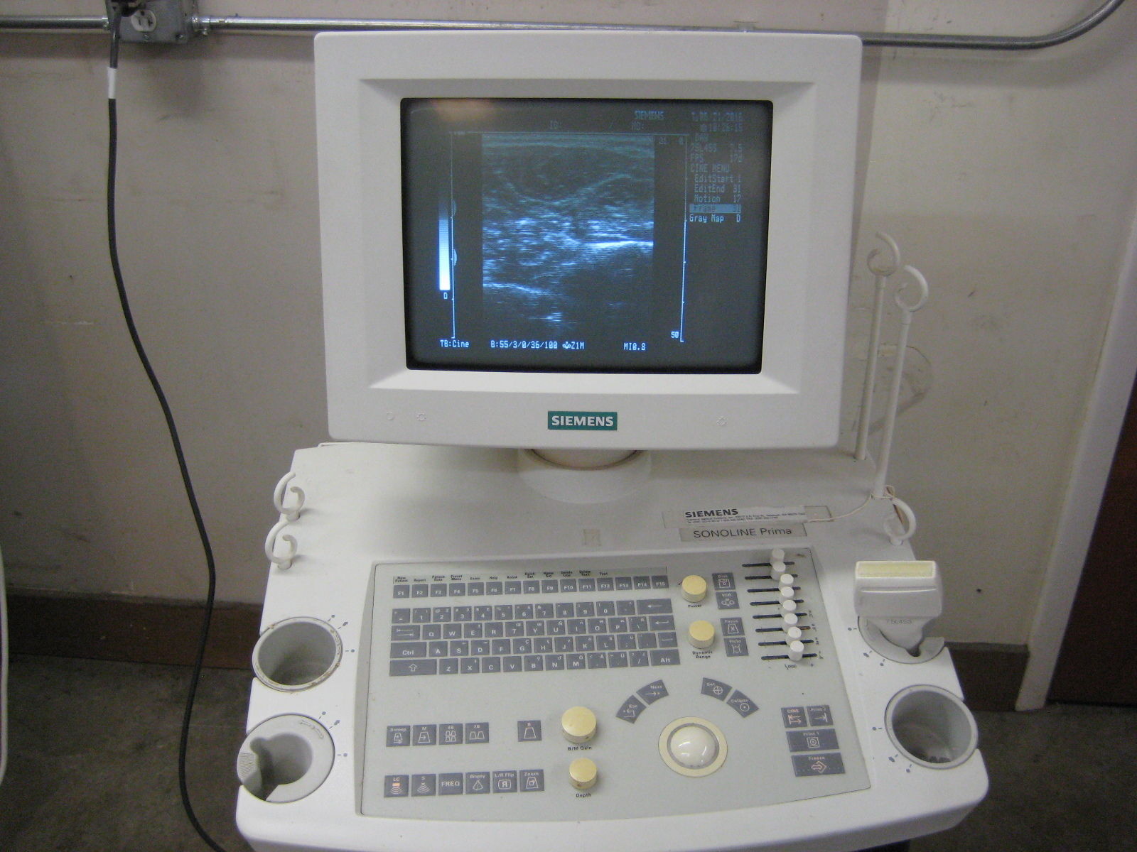 Siemens Sonoline Prima Ultrasound with Linear probe and printer. Guaranteed DIAGNOSTIC ULTRASOUND MACHINES FOR SALE