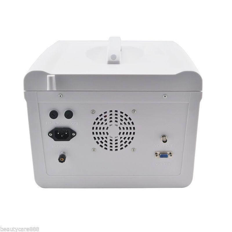 Portable Digital Ultrasound machine Scanner+3.5Mhz convex Probe+*3Dworkstation** 190891888099 DIAGNOSTIC ULTRASOUND MACHINES FOR SALE