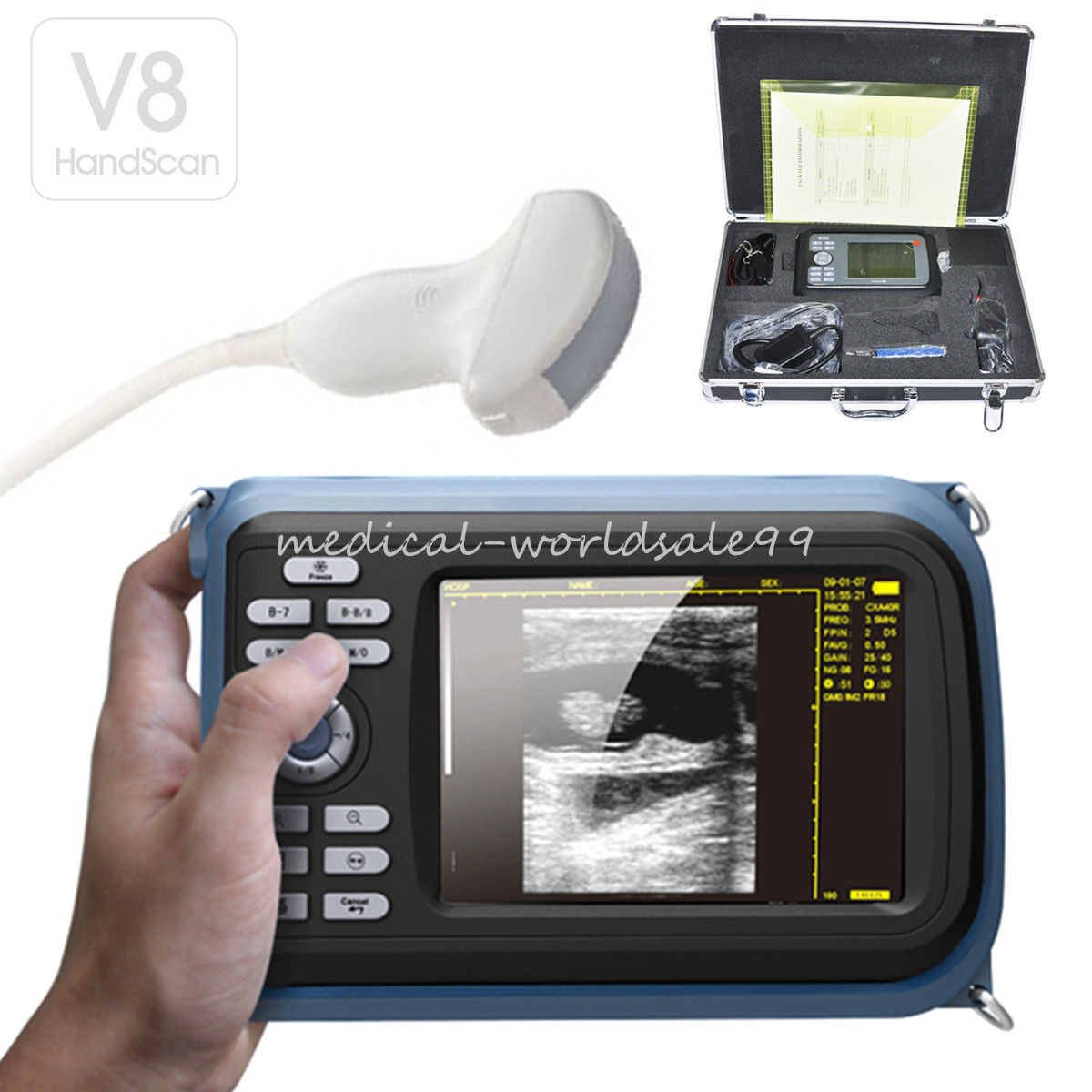 VET Handheld Ultrasound Scanner Machine + Micro-Convex Probe/Sensor Animal CE 190891523389 DIAGNOSTIC ULTRASOUND MACHINES FOR SALE