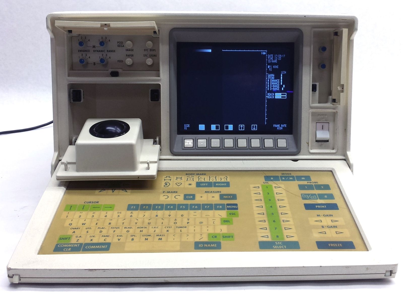 SHIMADZU SHIMASONIC SDL-310 OB/GYN ULTRASOUND DIAGNOSTIC IMAGING PATIENT MONTIOR DIAGNOSTIC ULTRASOUND MACHINES FOR SALE