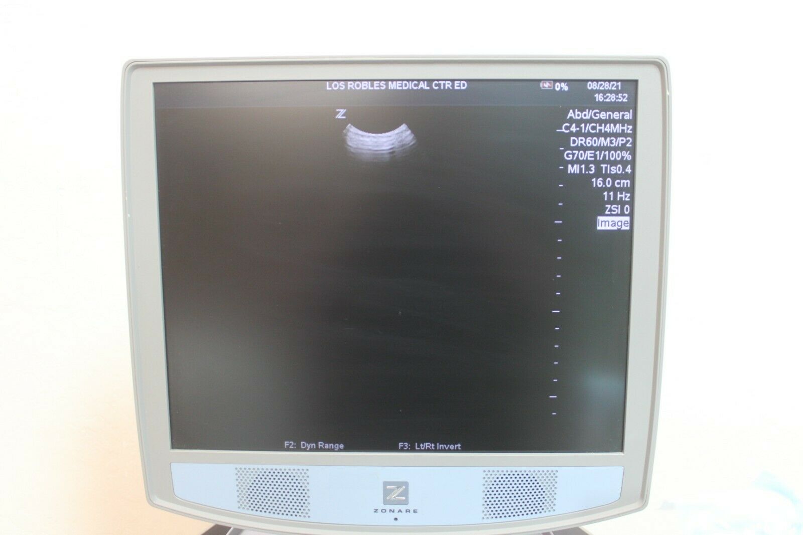 Zonare Z One Ultra Ultrasound with 3 Transducers DIAGNOSTIC ULTRASOUND MACHINES FOR SALE