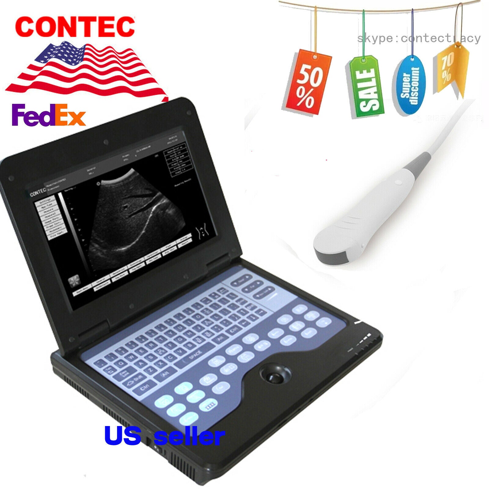 Full Digital B-Ultrasound diagnostic system Ultrasound Scanner 3.5M micro convex DIAGNOSTIC ULTRASOUND MACHINES FOR SALE