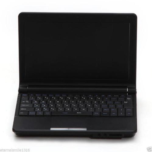 Laptop Ultrasound machine Scanner system 7.5Mhz High Frequecy Linear Probe+3D A+ DIAGNOSTIC ULTRASOUND MACHINES FOR SALE