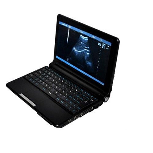 Digital Notebook Laptop Ultrasound Scanner/Machine with Convex + Linear Probe 3D 190891433589 DIAGNOSTIC ULTRASOUND MACHINES FOR SALE
