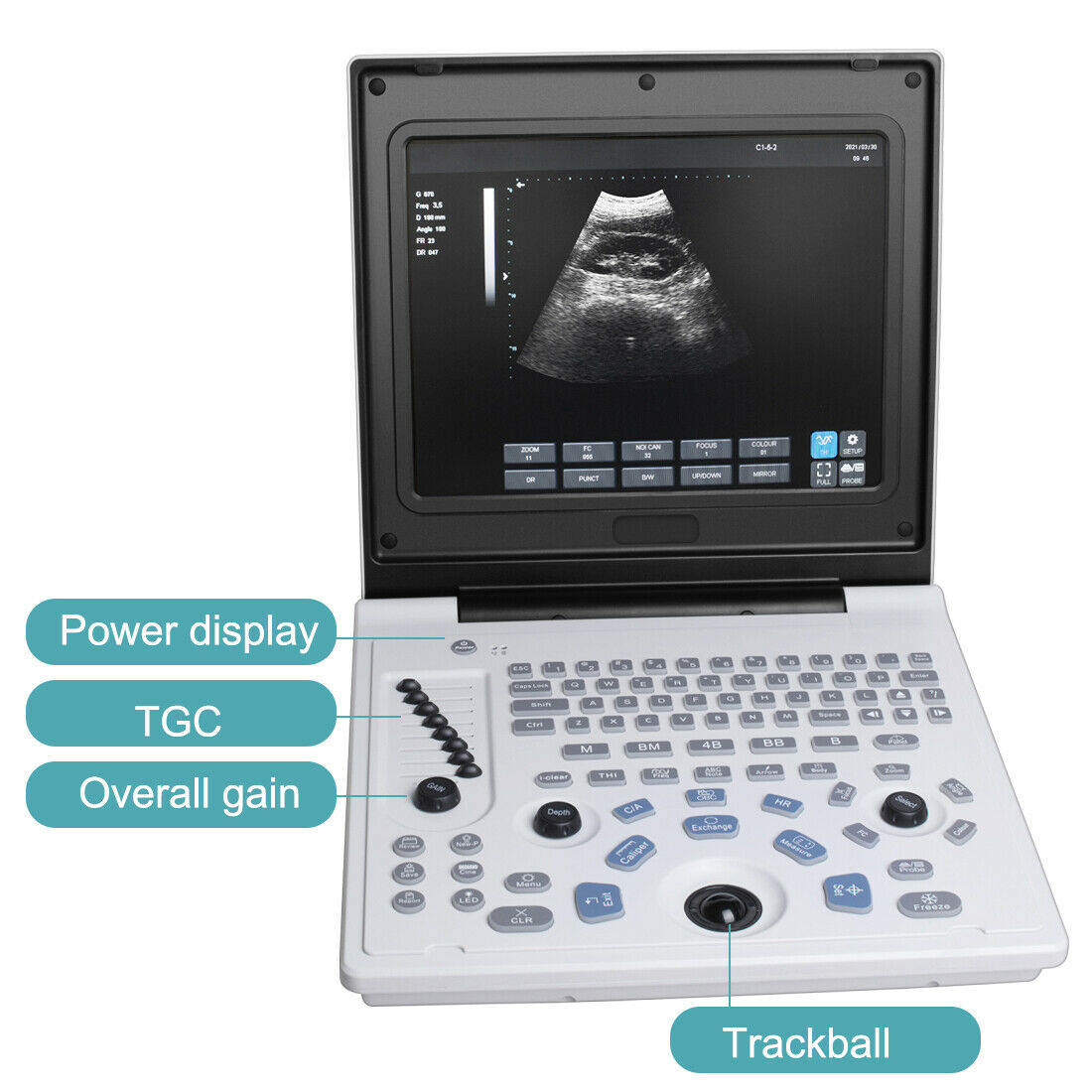 Portable 12 inch Digital Ultrasound Scanner Diagnostic Heart Rate System 3.5MHz DIAGNOSTIC ULTRASOUND MACHINES FOR SALE