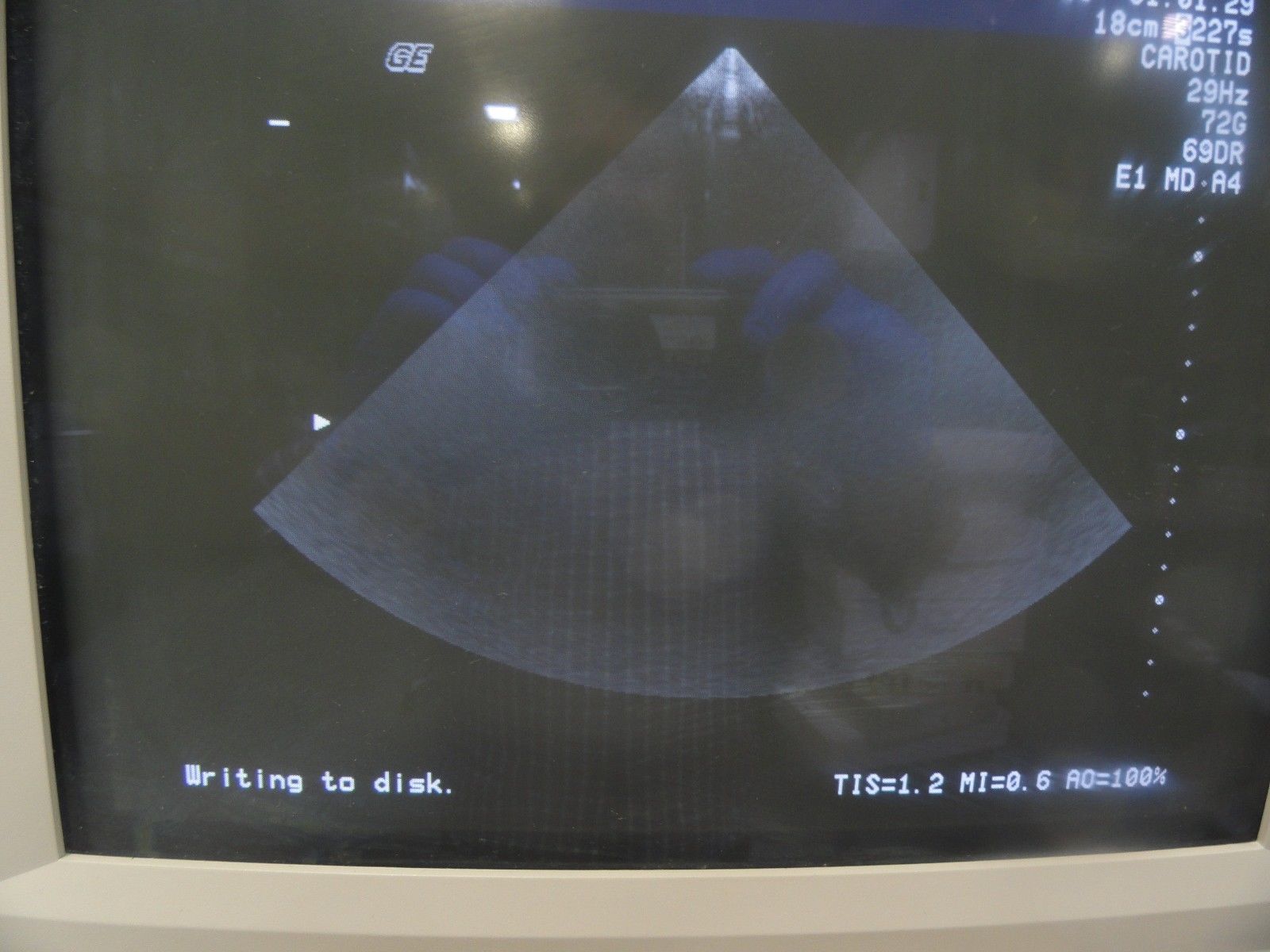 GE 227s P/N 2118743 Phased Array 2-4 MHz Probe W/ Hook for GE Logiq 700 (5979 DIAGNOSTIC ULTRASOUND MACHINES FOR SALE