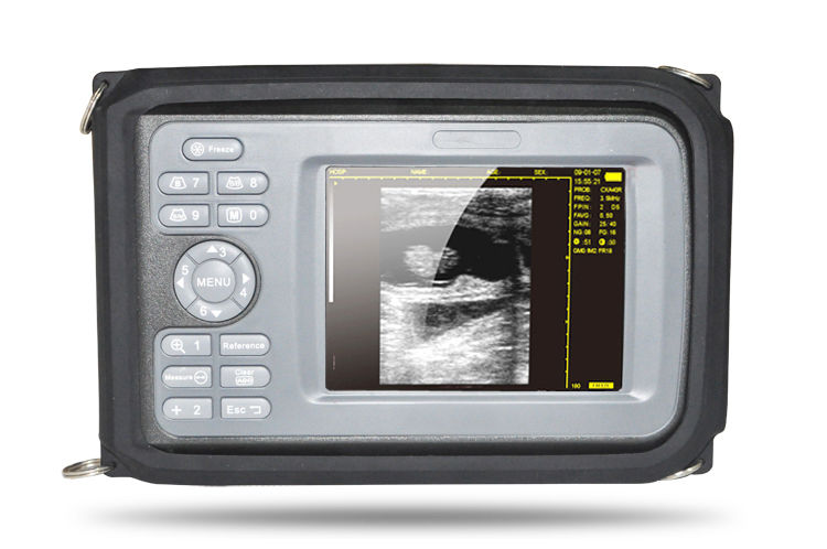 Laptop HandScan Digital Ultrasound Scanner system 7.5Mhz Linear Probe + Case 190891758767 DIAGNOSTIC ULTRASOUND MACHINES FOR SALE